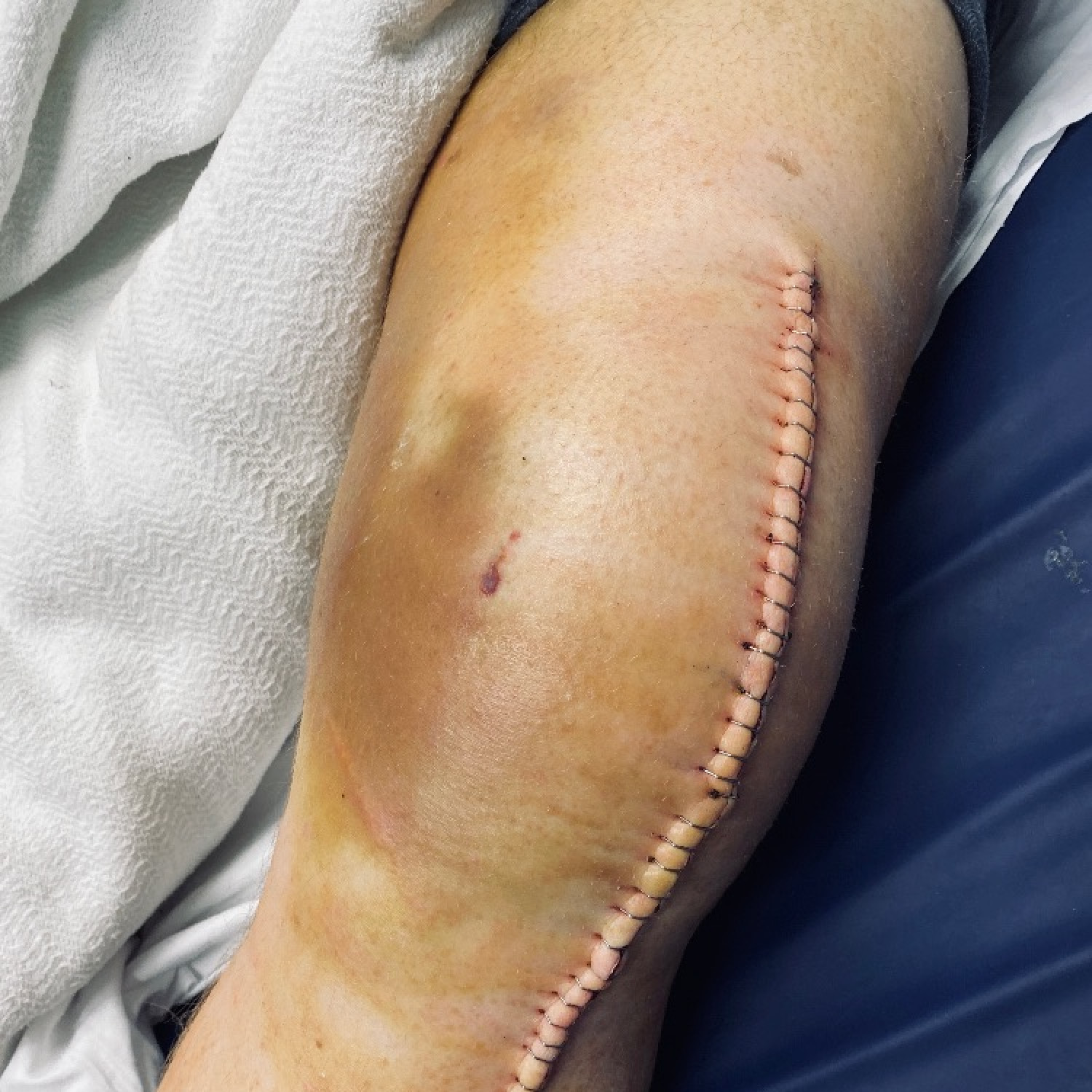 South Texas Orthopedic Specialists: Orthopedic Clinic | Sports Injury ... — Orthopedics clinic in Victoria, TX — photo 7