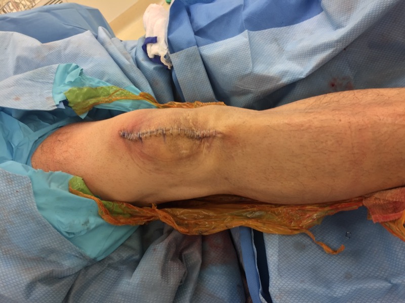 South Texas Orthopedic Specialists: Orthopedic Clinic | Sports Injury ... — Orthopedics clinic in Victoria, TX — photo 5