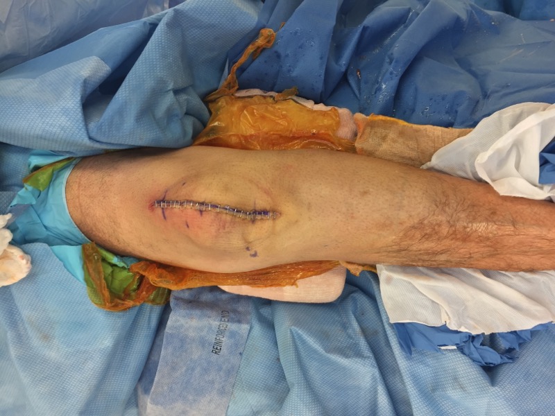 South Texas Orthopedic Specialists: Orthopedic Clinic | Sports Injury ... — Orthopedics clinic in Victoria, TX — photo 6